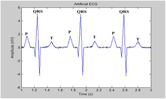 Determine the Heart Rate of an ECG Recording of Unknown properties Using MATLAB